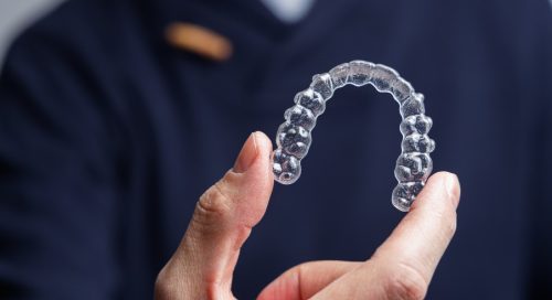 Advantages of Invisalign for Teens